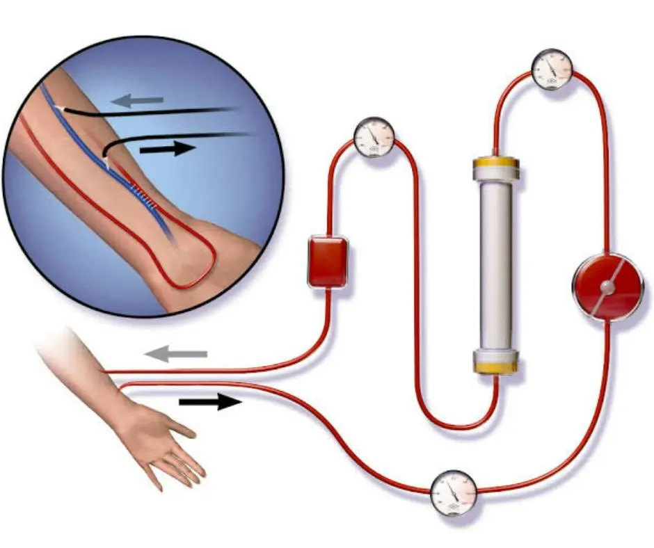 Benefits of electrotherapy and the latest physiotherapy techniques