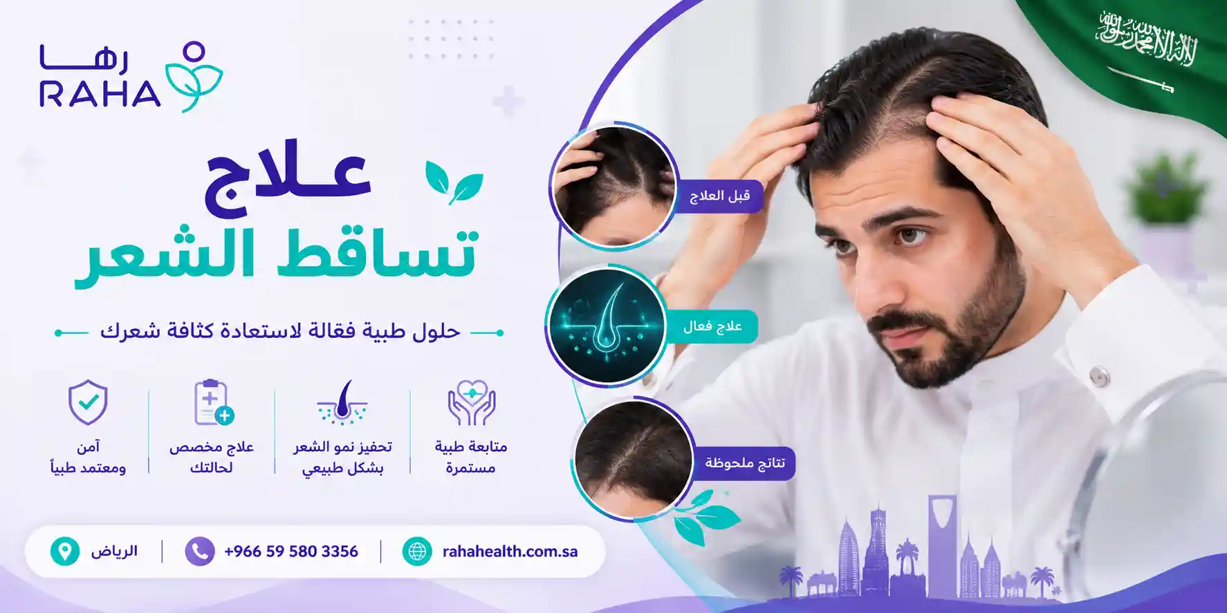 علاج تساقط الشعر